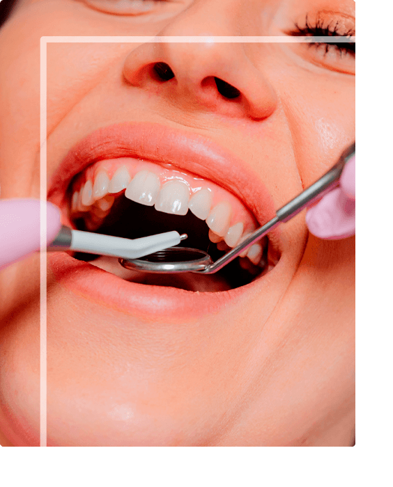 Cirurgia do dente do siso - Araruama - RJ