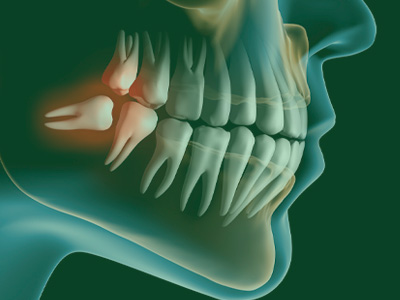 Tratamentos Odontológicos - Araruama - RJ